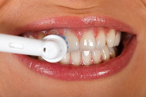 Teeth Whitening Costs at Dentists: Best Female Dentists in Karachi for Stunning Results