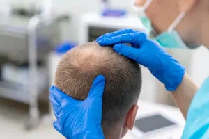 Hair transplantation in Abu Dhabi