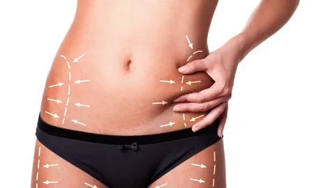 Liposuction in Abu Dhabi