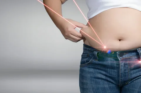 Liposuction in Abu Dhabi