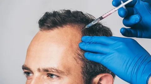 Plasma injection for hair in Abu Dhabi