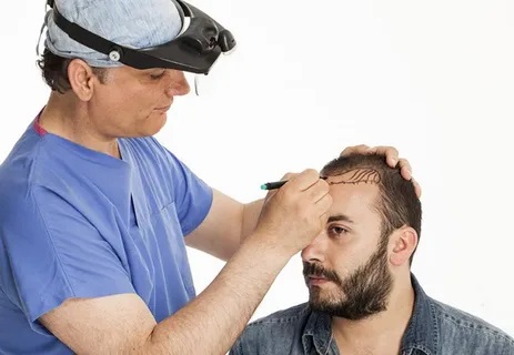 Hair Transplant in Riyadh