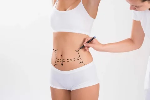 liposuction surgery in Jeddah