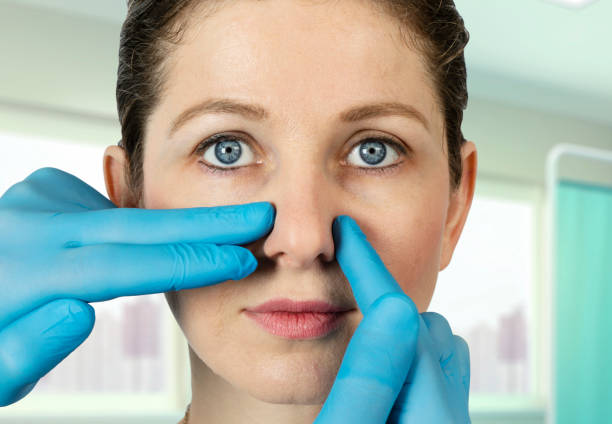 Rhinoplasty Cost: What You Should Expect