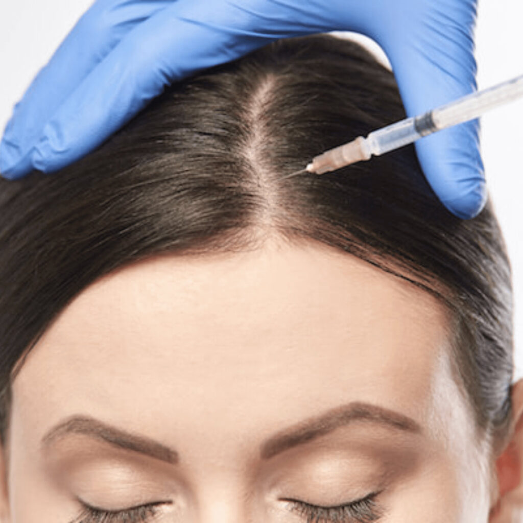 Are There Any Risks Associated with PRP Hair Treatment?