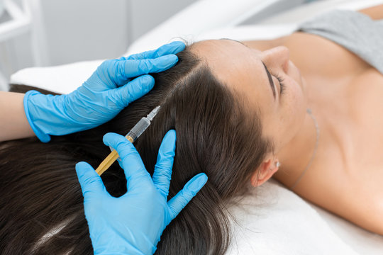 Are There Any Risks Associated with PRP Hair Treatment?