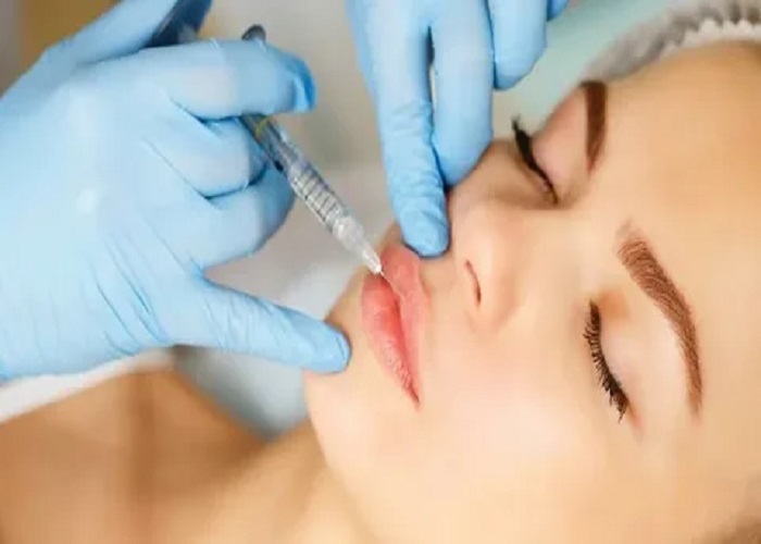 Lip Fillers Injections in Riyadh