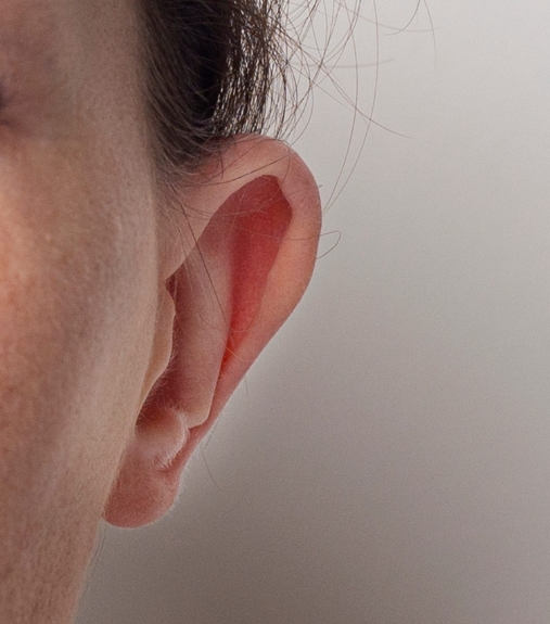 The Future of Ear Reshaping Techniques 