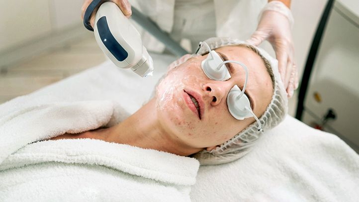 Transform Your Skin: Laser Acne Scar Treatment Insights