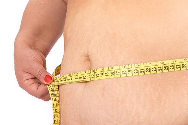 How to Prepare for BodyTite Liposuction 