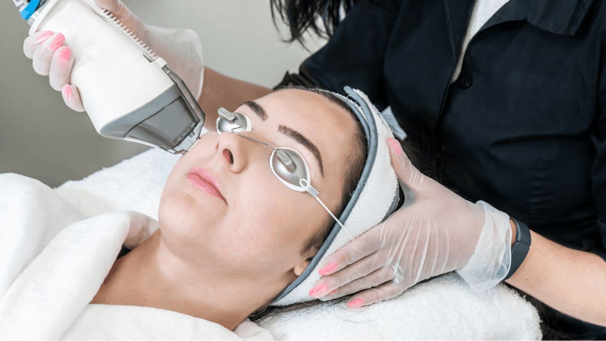 Innovative Laser Acne Scar Treatment