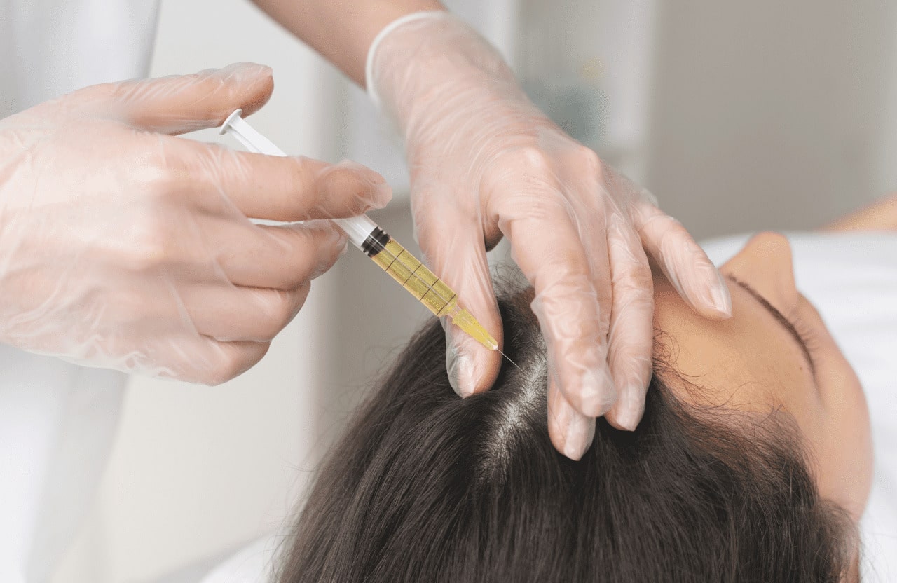 Restore Confidence with Hair Fillers Therapy