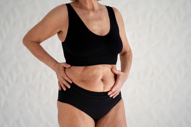 Steps to Recovery After a Tummy Tuck