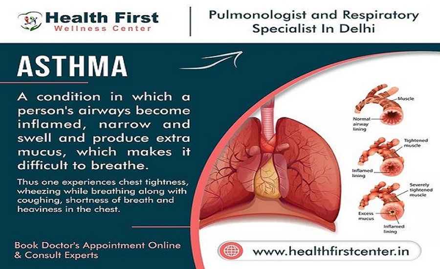 Best Asthma Doctor Near Me