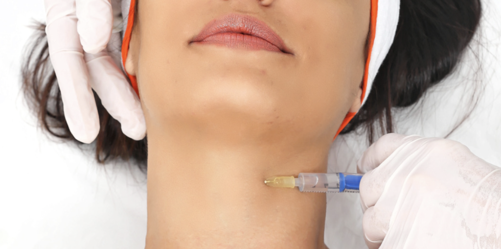 Botox Treatments for Turkey Neck