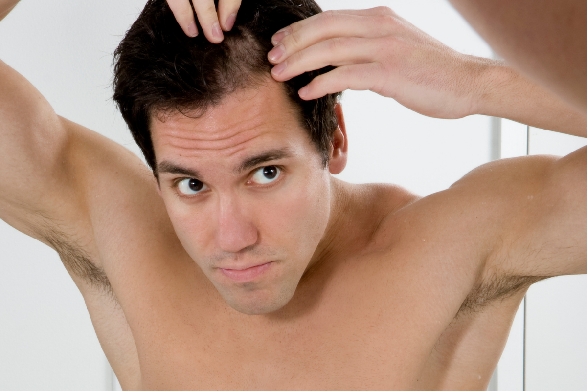 How Do Hair Transplants Address Receding Hairlines