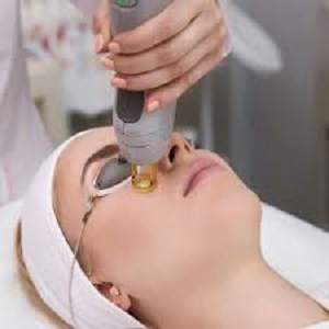 Laser Treatment in Riyadh