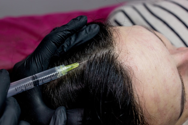 Long Lasting Results with PRP Hair Treatment 