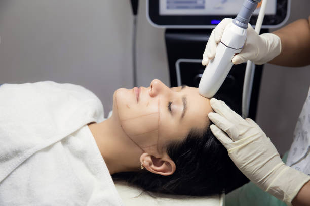 Painless Laser Skin Tightening                               