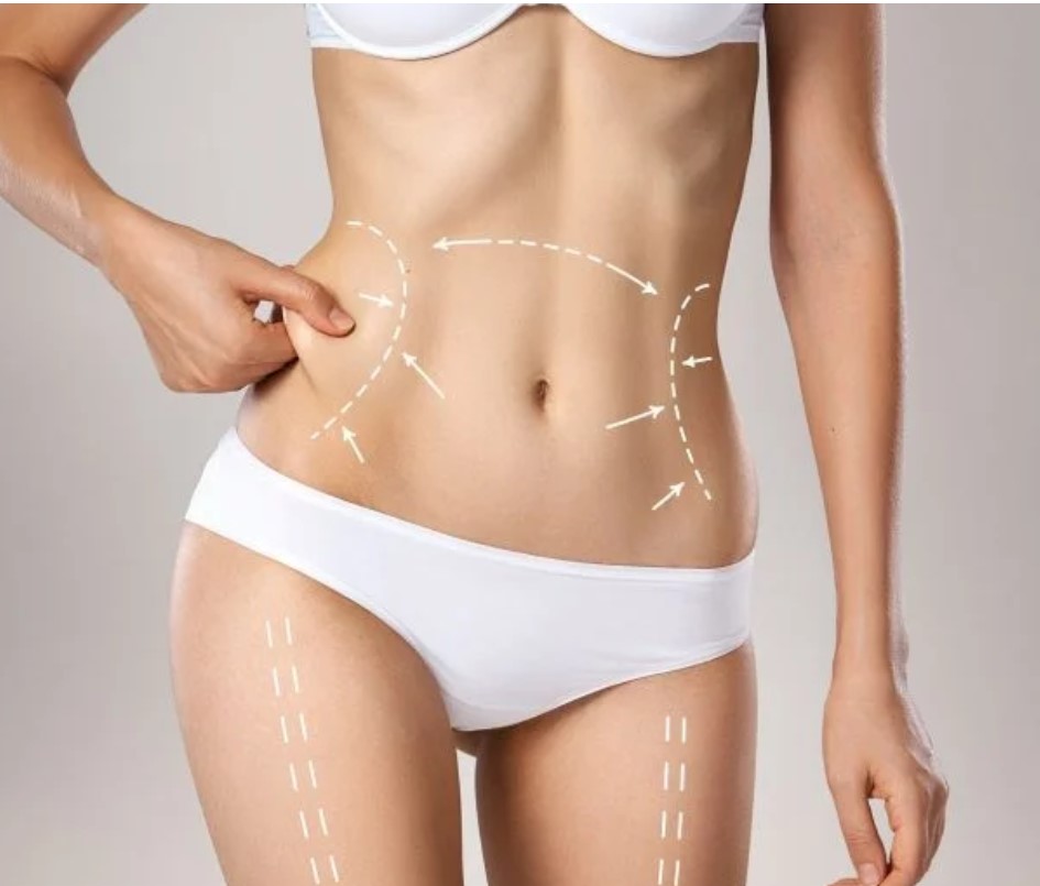 body contouring in dubai