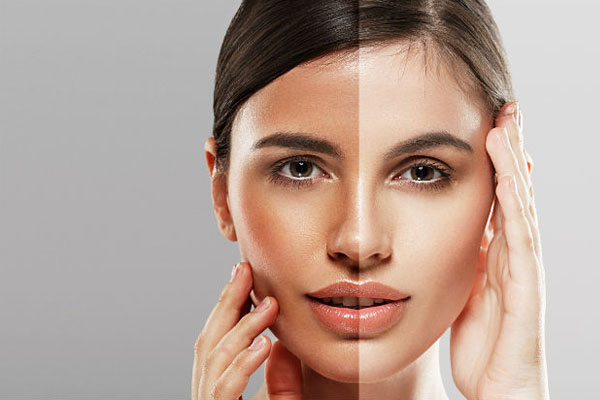 Is Laser Treatment a Safe Option for Permanent Skin Whitening?